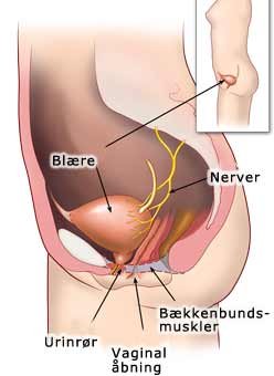 Bækkenbundsmuskler (Underliv anatomi)